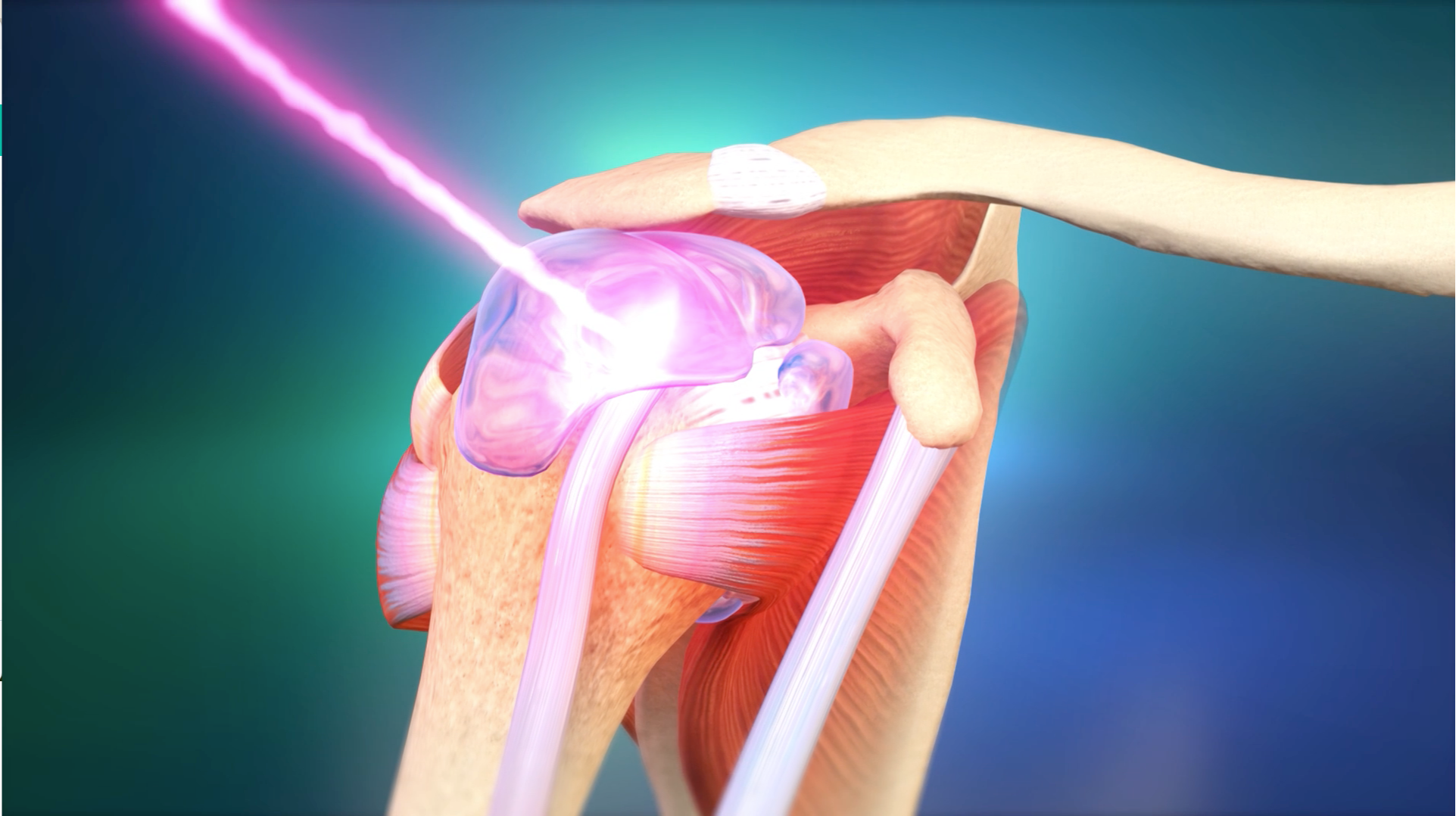 The Role of CureWave Lasers in Enhancing Primary Care Practices